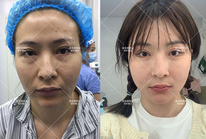 澳门三肖三码精准100%黄大仙的警惕虚假宣传-全面释义、实证解答解释落实